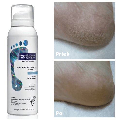 Footlogix Daily Maintenance Formula Putos kasdieninei pėdų priežiūrai  125ml
